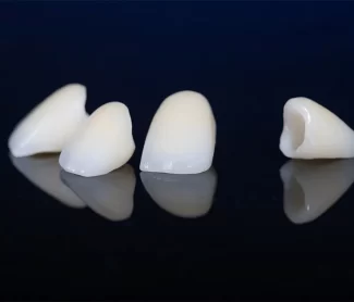 Tooth Pain After Damage? Dental Crowns Can Help