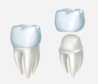 What Should I Do If My Dental Crown Falls Out? A Step-by-Step Guide for Phoenix Patients